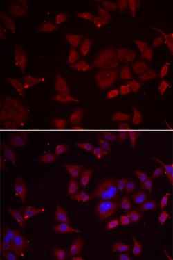Invitrogen PFKFB3 Polyclonal Antibody 100 &mu;L; Unconjugated:Antibodies,