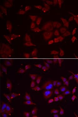 Invitrogen PFKFB3 Polyclonal Antibody 100 &mu;L; Unconjugated:Antibodies,