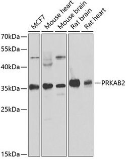 Invitrogen AMPK beta-2 Polyclonal Antibody 100 &mu;L; Unconjugated:Antibodies,