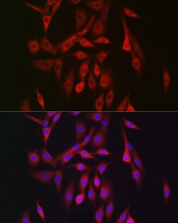Invitrogen AMPK beta-2 Polyclonal Antibody 100 &mu;L; Unconjugated:Antibodies,