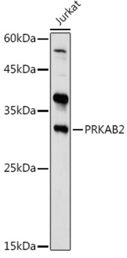 Invitrogen AMPK beta-2 Polyclonal Antibody 100 &mu;L; Unconjugated:Antibodies,
