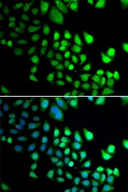 Invitrogen RBBP5 Polyclonal Antibody 100 &mu;L; Unconjugated:Antibodies,