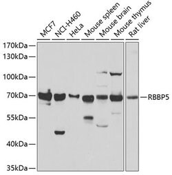 Invitrogen RBBP5 Polyclonal Antibody 100 &mu;L; Unconjugated:Antibodies,