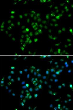 Invitrogen RBBP6 Polyclonal Antibody 100 &mu;L; Unconjugated:Antibodies,