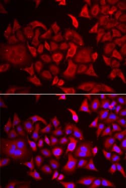 Invitrogen TARS Polyclonal Antibody 100 &mu;L; Unconjugated:Antibodies,