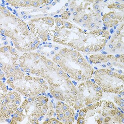 Invitrogen TARS Polyclonal Antibody 100 &mu;L; Unconjugated:Antibodies,