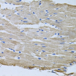 Invitrogen TARS Polyclonal Antibody 100 &mu;L; Unconjugated:Antibodies,