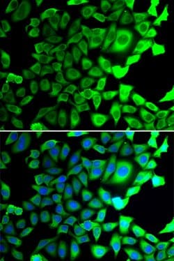 Invitrogen USP8 Polyclonal Antibody 100 &mu;L; Unconjugated:Antibodies,