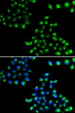 Invitrogen COPB2 Polyclonal Antibody 100 &mu;L; Unconjugated:Antibodies,