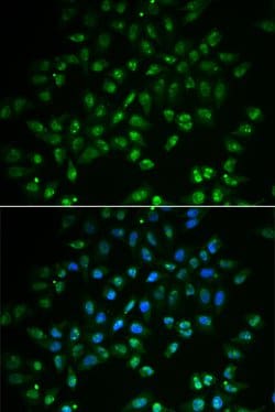 Invitrogen HAND2 Polyclonal Antibody 100 &mu;L; Unconjugated:Antibodies,