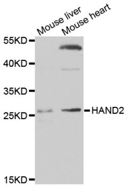 Invitrogen HAND2 Polyclonal Antibody 100 &mu;L; Unconjugated:Antibodies,