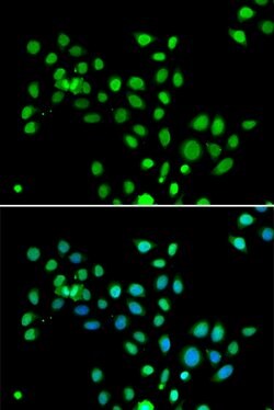 Invitrogen Histone Macro-H2A.1 Polyclonal Antibody 100 &mu;L; Unconjugated:Antibodies,