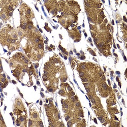 Invitrogen STAMBP Polyclonal Antibody 100 &mu;L; Unconjugated:Antibodies,