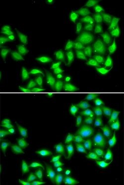 Invitrogen OGFR Polyclonal Antibody 100 &mu;L; Unconjugated:Antibodies,