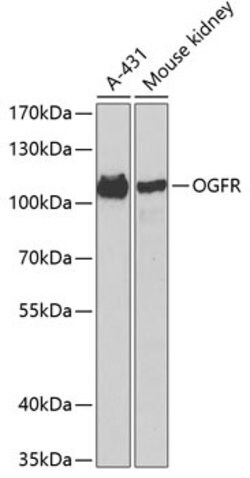 Invitrogen OGFR Polyclonal Antibody 100 &mu;L; Unconjugated:Antibodies,