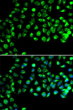 Invitrogen GTL3 Polyclonal Antibody 100 &mu;L; Unconjugated:Antibodies,