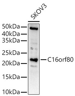 Invitrogen GTL3 Polyclonal Antibody 100 &mu;L; Unconjugated:Antibodies,