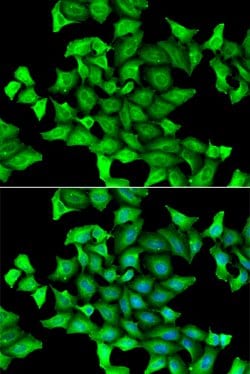 Invitrogen SLA/LP Polyclonal Antibody 100 &mu;L; Unconjugated:Antibodies,