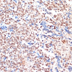 Invitrogen NAA20 Polyclonal Antibody 100 &mu;L; Unconjugated:Antibodies,