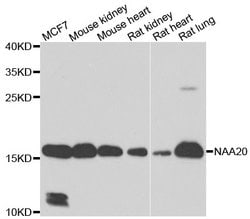 Invitrogen NAA20 Polyclonal Antibody 100 &mu;L; Unconjugated:Antibodies,