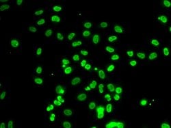 Invitrogen BAF53B Polyclonal Antibody 100 &mu;L; Unconjugated:Antibodies,