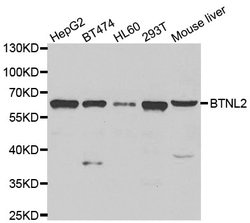 Invitrogen BTNL2 Polyclonal Antibody 100 &mu;L; Unconjugated:Antibodies,
