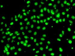Invitrogen MEPCE Polyclonal Antibody 100 μL; Unconjugated:Antibodies,