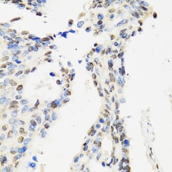 Invitrogen DBC1 Polyclonal Antibody 100 &mu;L; Unconjugated:Antibodies,