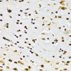 Invitrogen DBC1 Polyclonal Antibody 100 &mu;L; Unconjugated:Antibodies,