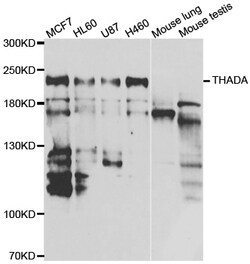 Invitrogen THADA Polyclonal Antibody 100 &mu;L; Unconjugated:Antibodies,