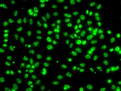 Invitrogen AXUD1 Polyclonal Antibody 100 &mu;L; Unconjugated:Antibodies,