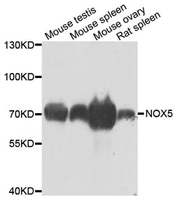 Invitrogen NOX5 Polyclonal Antibody 100 &mu;L; Unconjugated:Antibodies,