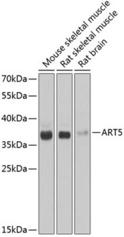 Invitrogen ART5 Polyclonal Antibody 100 &mu;L; Unconjugated:Antibodies,