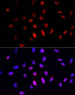 COMMD1 Polyclonal Antibody:Antibodies, Polyclonal
