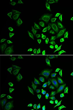 PLA2G2D Polyclonal Antibody:Antibodies, Polyclonal