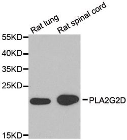 PLA2G2D Polyclonal Antibody, Invitrogen 100 &mu;L; Unconjugated:Antibodies,