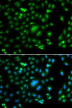 Invitrogen ELF5 Polyclonal Antibody 100 &mu;L; Unconjugated:Antibodies,