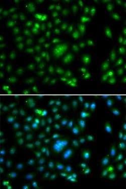 Invitrogen ELF5 Polyclonal Antibody 100 &mu;L; Unconjugated:Antibodies,