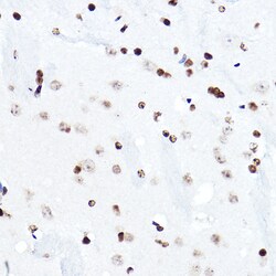 Invitrogen ELF5 Polyclonal Antibody 100 &mu;L; Unconjugated:Antibodies,