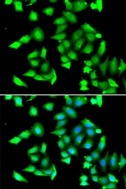 Invitrogen GSTCD Polyclonal Antibody 100 &mu;L; Unconjugated:Antibodies,