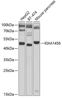 Invitrogen KIAA1456 Polyclonal Antibody 100 &mu;L; Unconjugated:Antibodies,