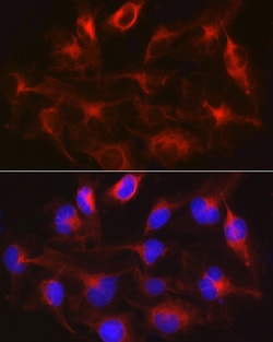 Invitrogen METTL7B Polyclonal Antibody 100 &mu;L; Unconjugated:Antibodies,