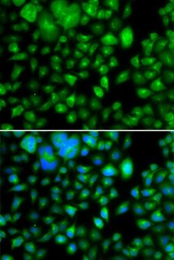 Invitrogen METTL7B Polyclonal Antibody 100 &mu;L; Unconjugated:Antibodies,