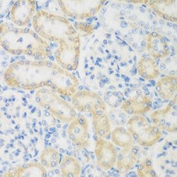 Invitrogen NAT8B Polyclonal Antibody 100 &mu;L | Buy Online | Invitrogen&trade; | Fisher Scientific