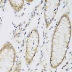 Invitrogen NAT8B Polyclonal Antibody 100 &mu;L | Buy Online | Invitrogen&trade; | Fisher Scientific