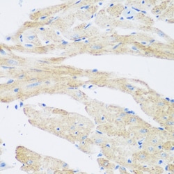 Invitrogen NAT8B Polyclonal Antibody 100 &mu;L | Buy Online | Invitrogen&trade; | Fisher Scientific