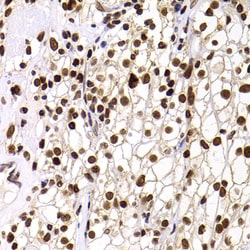 Invitrogen PHIP Polyclonal Antibody 100 &mu;L; Unconjugated:Antibodies,