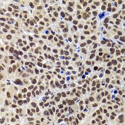 Invitrogen PHIP Polyclonal Antibody 100 &mu;L; Unconjugated:Antibodies,