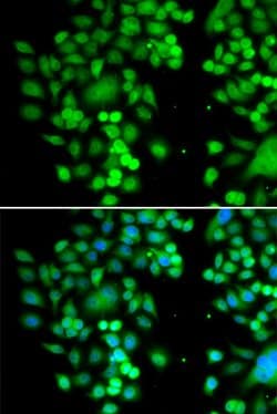Invitrogen PHYHD1 Polyclonal Antibody 100 &mu;L; Unconjugated:Antibodies,