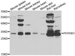 Invitrogen PHYHD1 Polyclonal Antibody 100 &mu;L; Unconjugated:Antibodies,